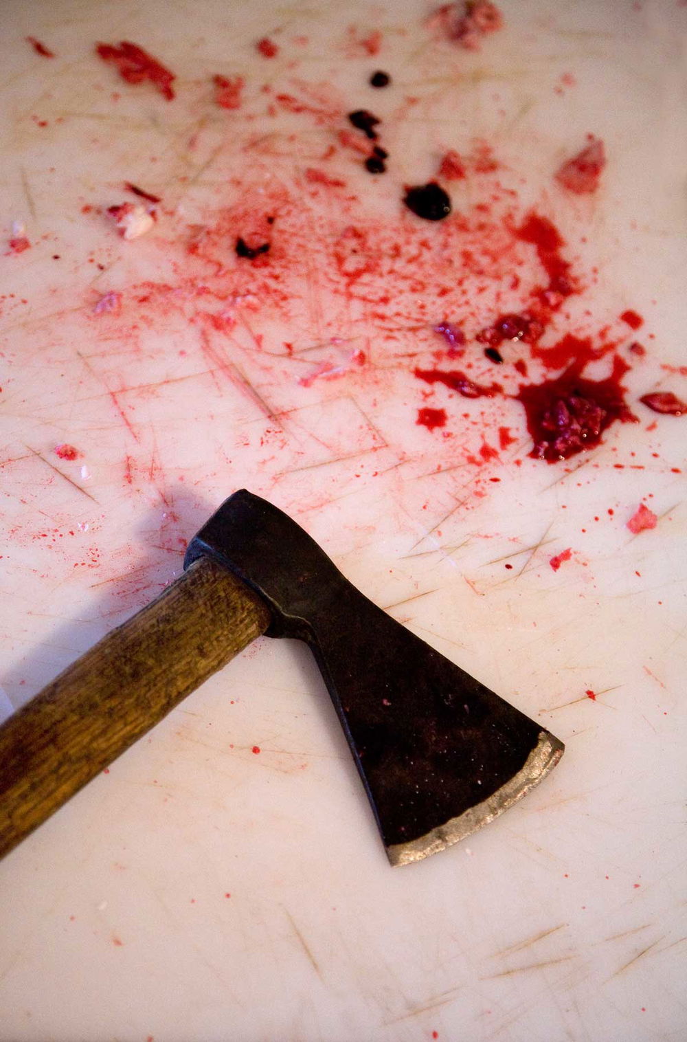 Come fermare il sangue da una ferita da taglio | Donna Moderna